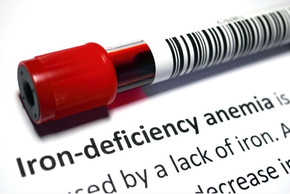 انواع کم خونی در کودکان