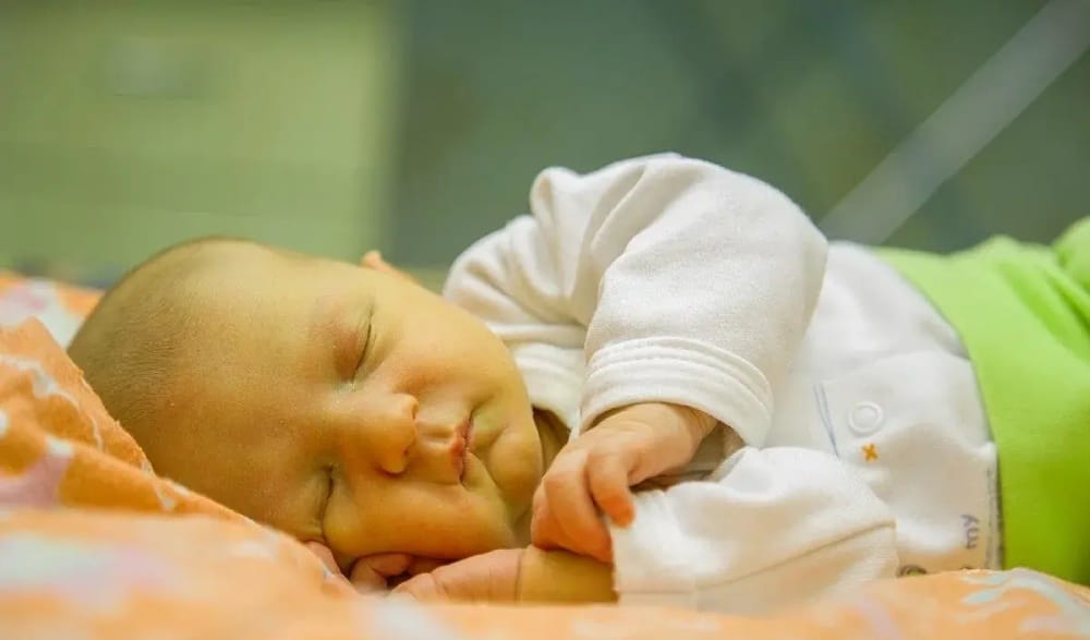 زردی نوزادان