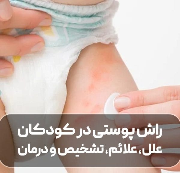 راش پوستی در کودکان