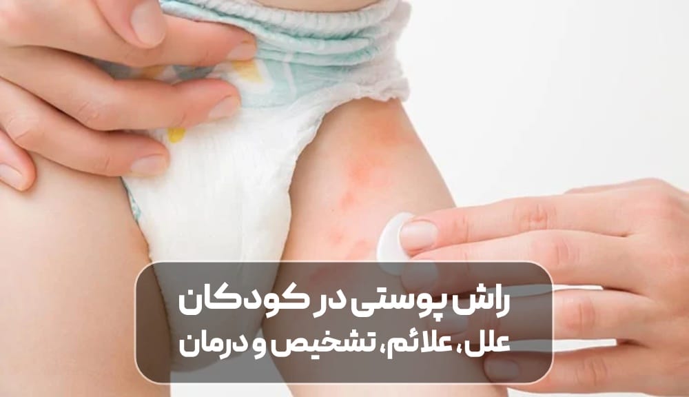 راش پوستی در کودکان