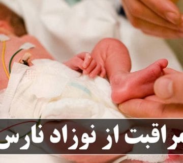 مراقبت از نوزاد نارس