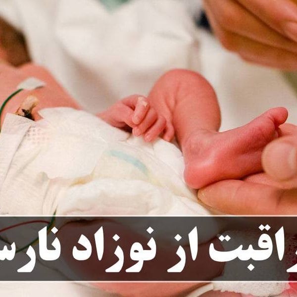 مراقبت از نوزاد نارس