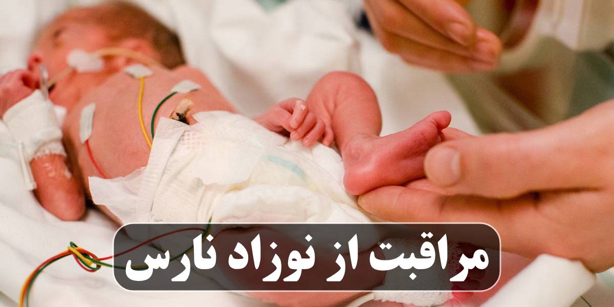 مراقبت از نوزاد نارس