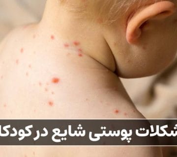 مشکلات پوستی شایع در کودکان