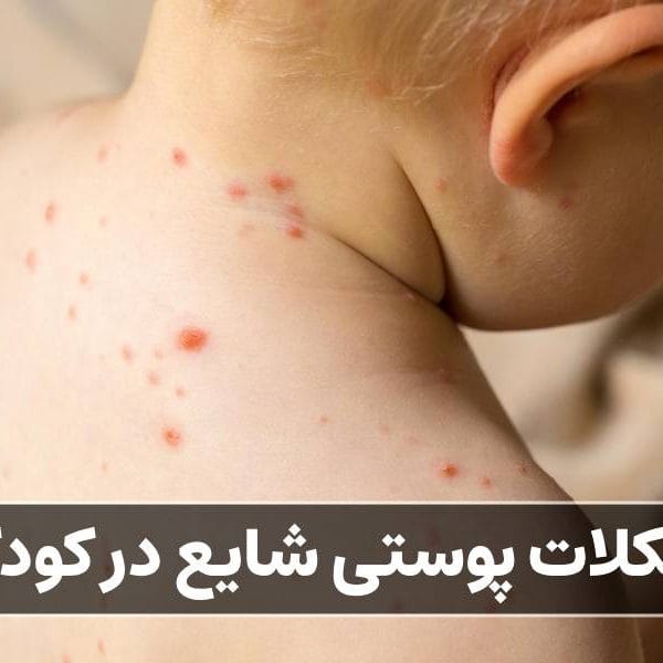 مشکلات پوستی شایع در کودکان